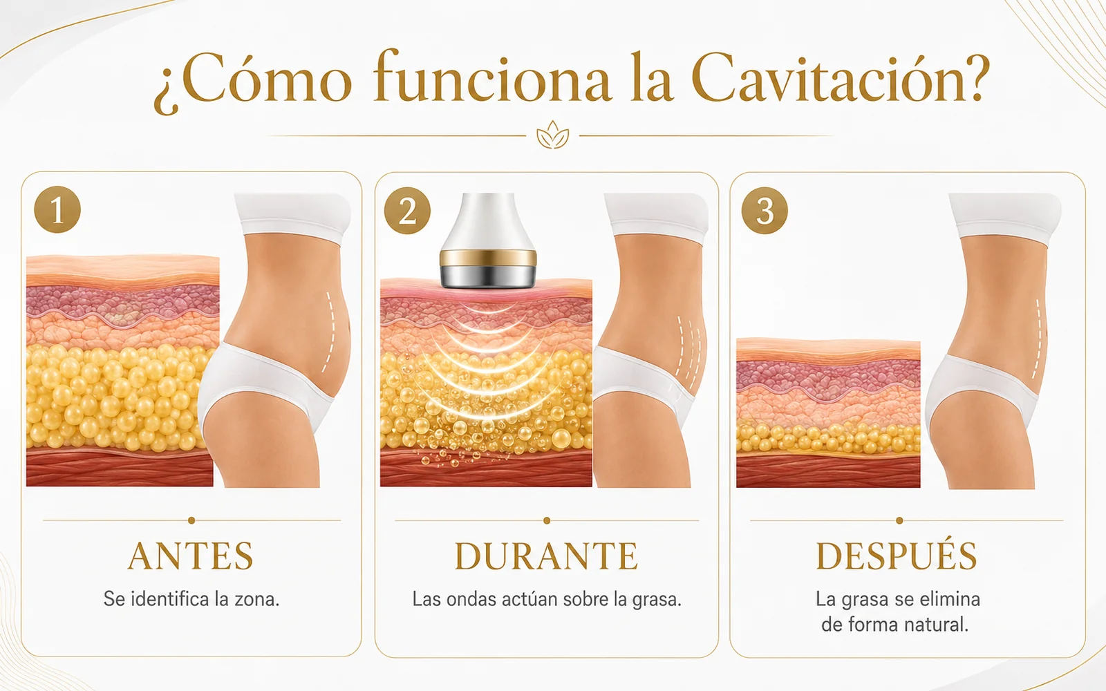 Cavitación Corporal