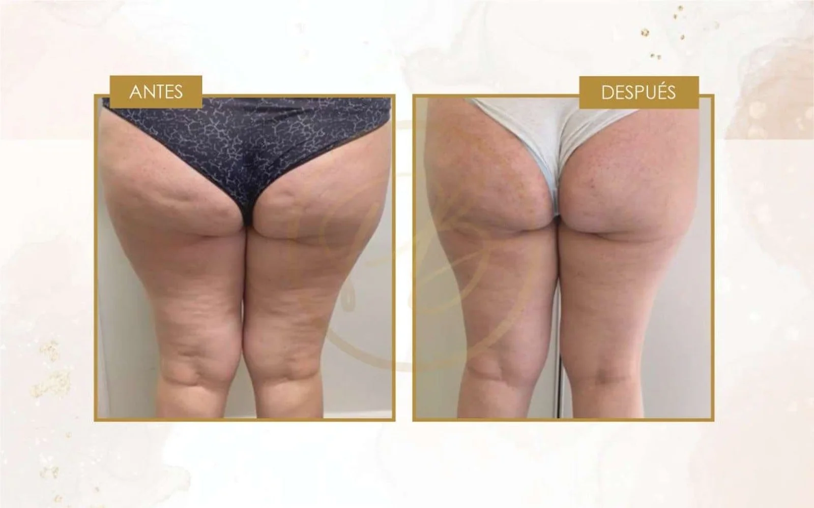 Despues 2