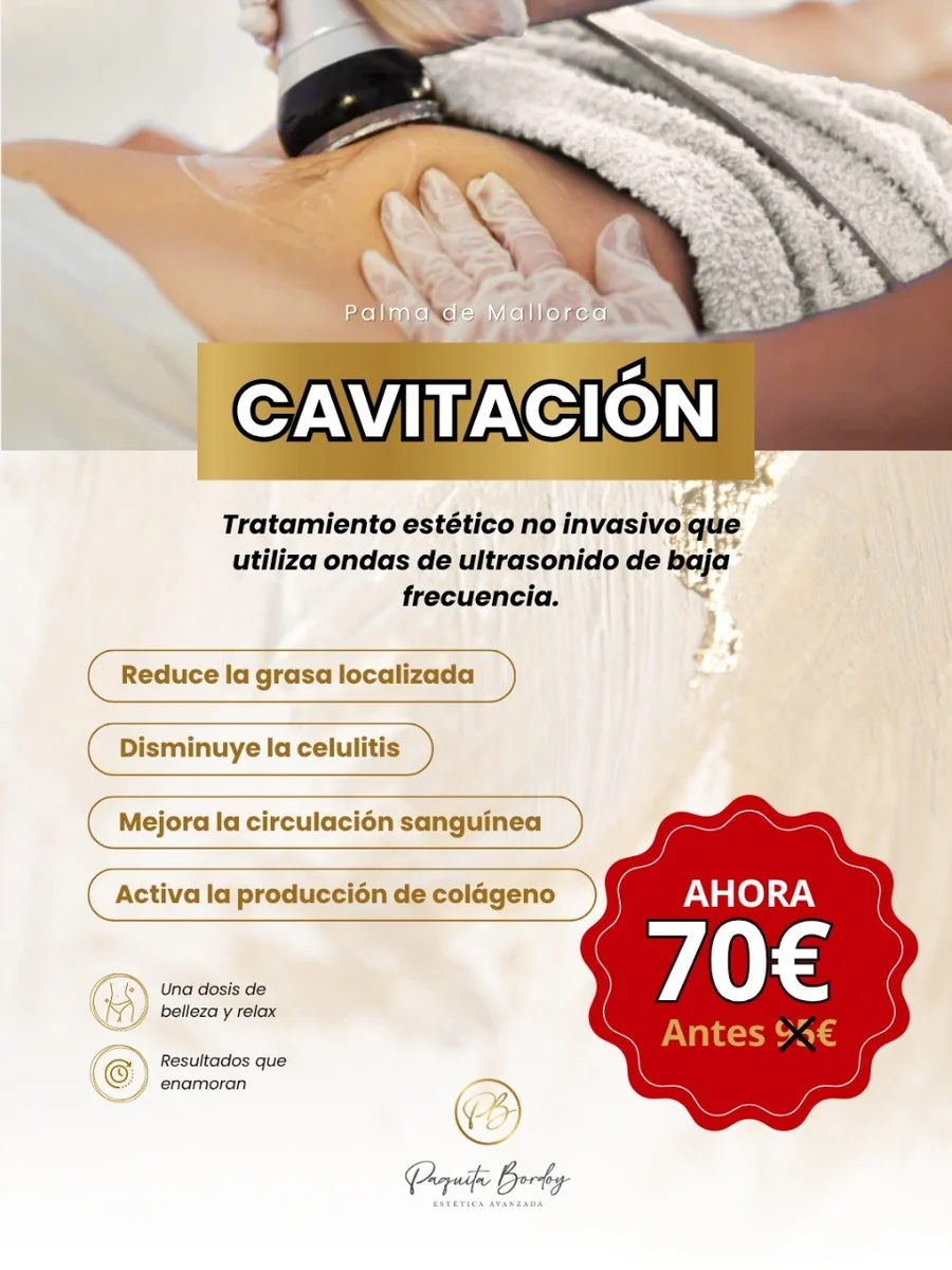 Cavitación Corporal