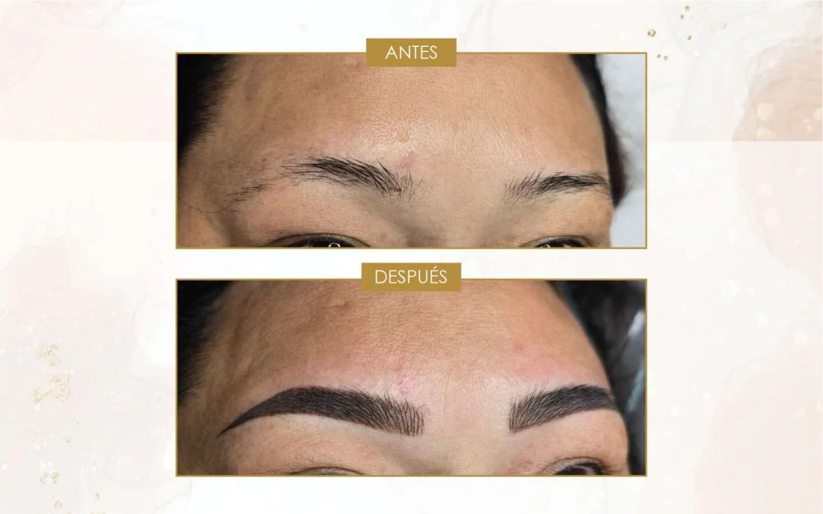 Antes 1