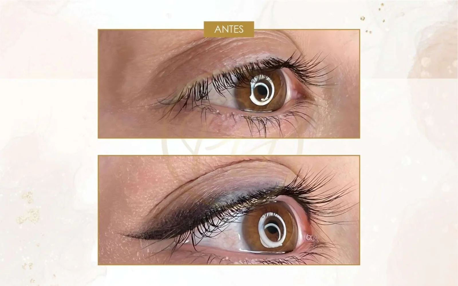 Antes 1