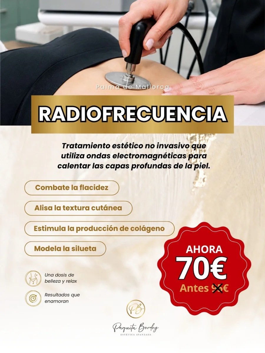 Radiofrecuencia Corporal
